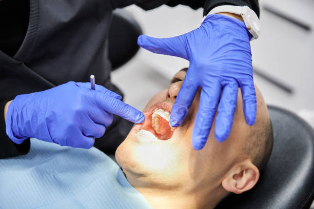 Best Dentist for Tooth Abscess  in Parkway, CA